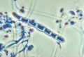 TRICHOPHYTON